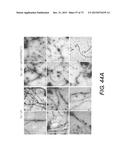 USE OF P3 OF BACTERIOPHAGE FUSION PROTEINS AS AMYLOID BINDING AGENTS diagram and image