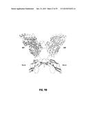 Norrin Mutant Polypeptides, Methods of Making and Uses Thereof diagram and image