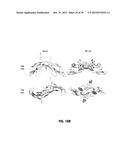 Norrin Mutant Polypeptides, Methods of Making and Uses Thereof diagram and image