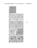 Use of NKG2D Inhibitors for Treating Cardiovascular and Metabolic     Diseases, Such as Type 2 Diabetes diagram and image