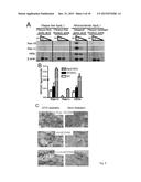 Use of NKG2D Inhibitors for Treating Cardiovascular and Metabolic     Diseases, Such as Type 2 Diabetes diagram and image