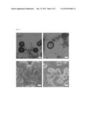 BIOENVIRONMENT-SENSITIVE NANOPARTICLE COMPRISING POLYMER HAVING     COMPLEMENTARY CHARGES diagram and image