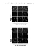 BIOENVIRONMENT-SENSITIVE NANOPARTICLE COMPRISING POLYMER HAVING     COMPLEMENTARY CHARGES diagram and image