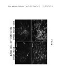 AUTOLOGOUS AND ALLOGENIC ADIPOSE-DERIVED STROMAL STEM CELL COMPOSITION FOR     TREATING FISTULAS diagram and image