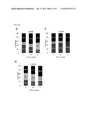 ANALYTICAL METHOD FOR INCREASING SUSCEPTIBILITY OF MOLECULAR TARGETED     THERAPY IN HEPATOCELLULAR CARCINOMA diagram and image