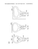 PRESS FIT STORM WINDOW SYSTEM diagram and image