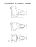 PRESS FIT STORM WINDOW SYSTEM diagram and image