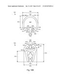 PRESS FIT STORM WINDOW SYSTEM diagram and image