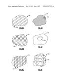 GAS TURBINE ENGINE COMPONENT EXTERNAL SURFACE MICRO-CHANNEL COOLING diagram and image