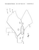 LARGE DIAMETER FAN HAVING LOW PROFILE RADIAL AIR GAP MOTOR diagram and image