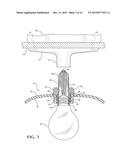 LAMP RETROFITTING ASSEMBLY diagram and image