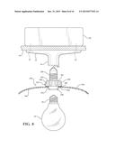 LAMP RETROFITTING ASSEMBLY diagram and image