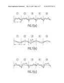 IMPROVEMENT OF TIRE UNIFORMITY THROUGH IDENTIFICATION OF PROCESS EFFECTS     USING REGRESSION ANALYSIS WITHOUT AZIMUTH DATA diagram and image