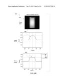 METHOD AND APPARATUS FOR SLAB SELECTION IN ULTRASHORT ECHO TIME 3-D MRI diagram and image