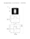 METHOD AND APPARATUS FOR SLAB SELECTION IN ULTRASHORT ECHO TIME 3-D MRI diagram and image