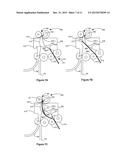 Dual Input Bump Alignment Assembly for an Imaging Device diagram and image