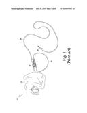 ULTRASONIC IDENTIFICATION OF REPLACEABLE COMPONENT FOR HOST SYSTEM diagram and image