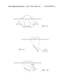 PHYSICAL-VIRTUAL PATIENT BED SYSTEM diagram and image