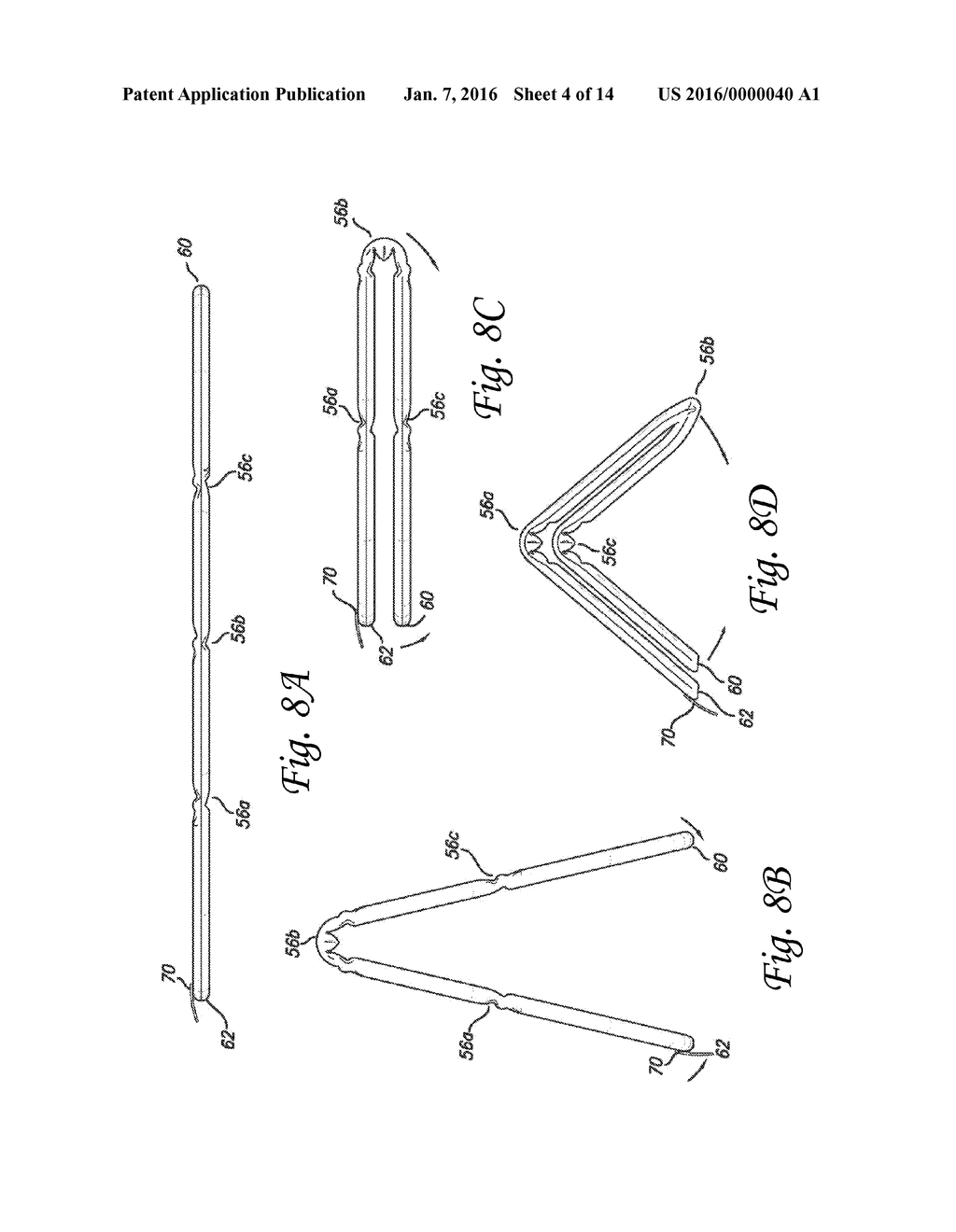 Pet Protective Collar With Stays And Ventilation - diagram, schematic, and image 05