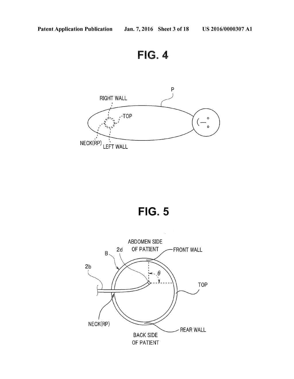 ENDOSCOPE SYSTEM AND ACTUATION METHOD FOR ENDOSCOPE SYSTEM - diagram, schematic, and image 04