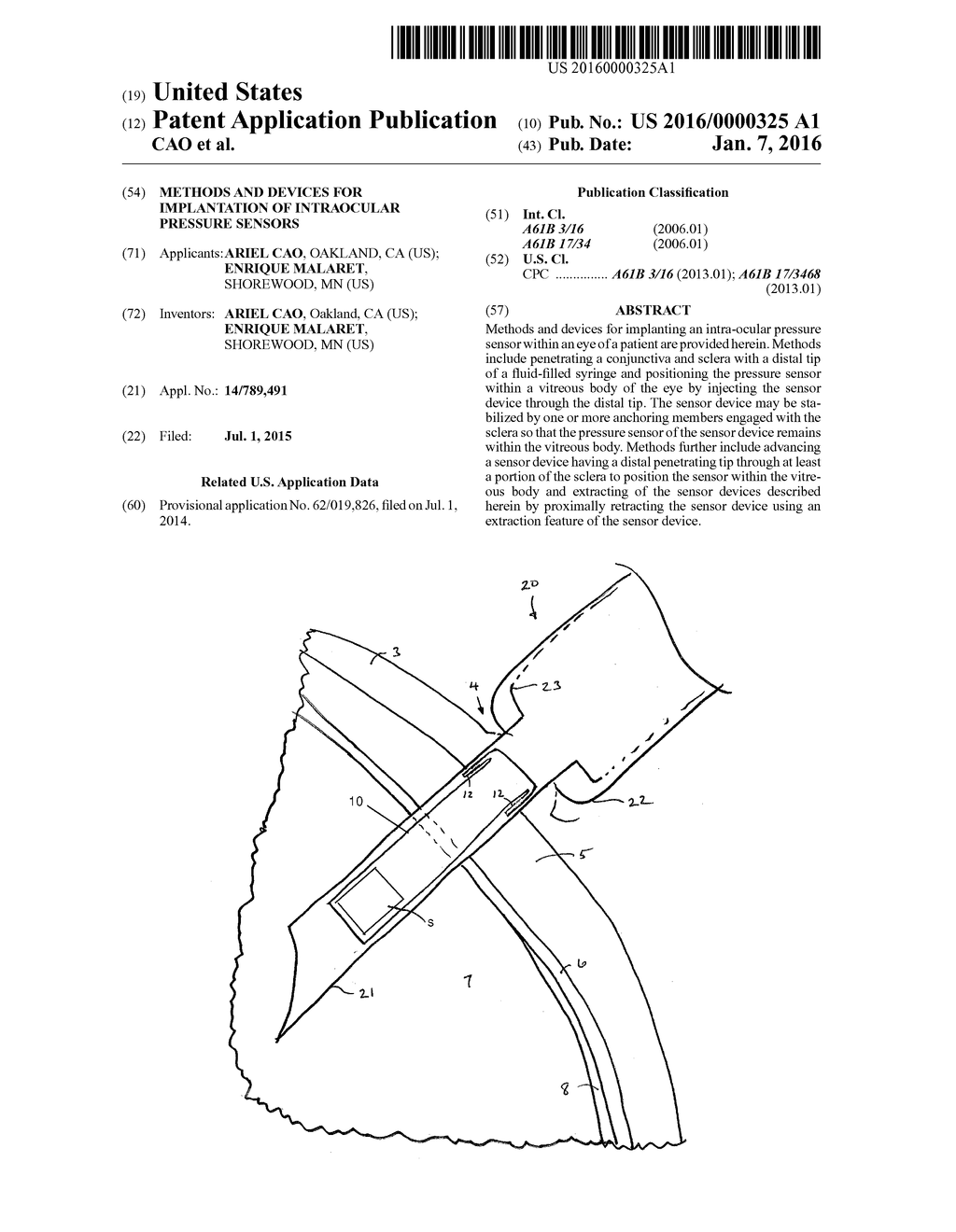 METHODS AND DEVICES FOR IMPLANTATION OF INTRAOCULAR PRESSURE SENSORS - diagram, schematic, and image 01