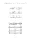 Human Body Movement State Monitoring Method And Device diagram and image