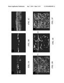 SYSTEMS AND METHODS FOR IN VIVO VISUALIZATION OF LYMPHATIC VESSELS WITH     OPTICAL COHERENCE TOMOGRAPHY diagram and image