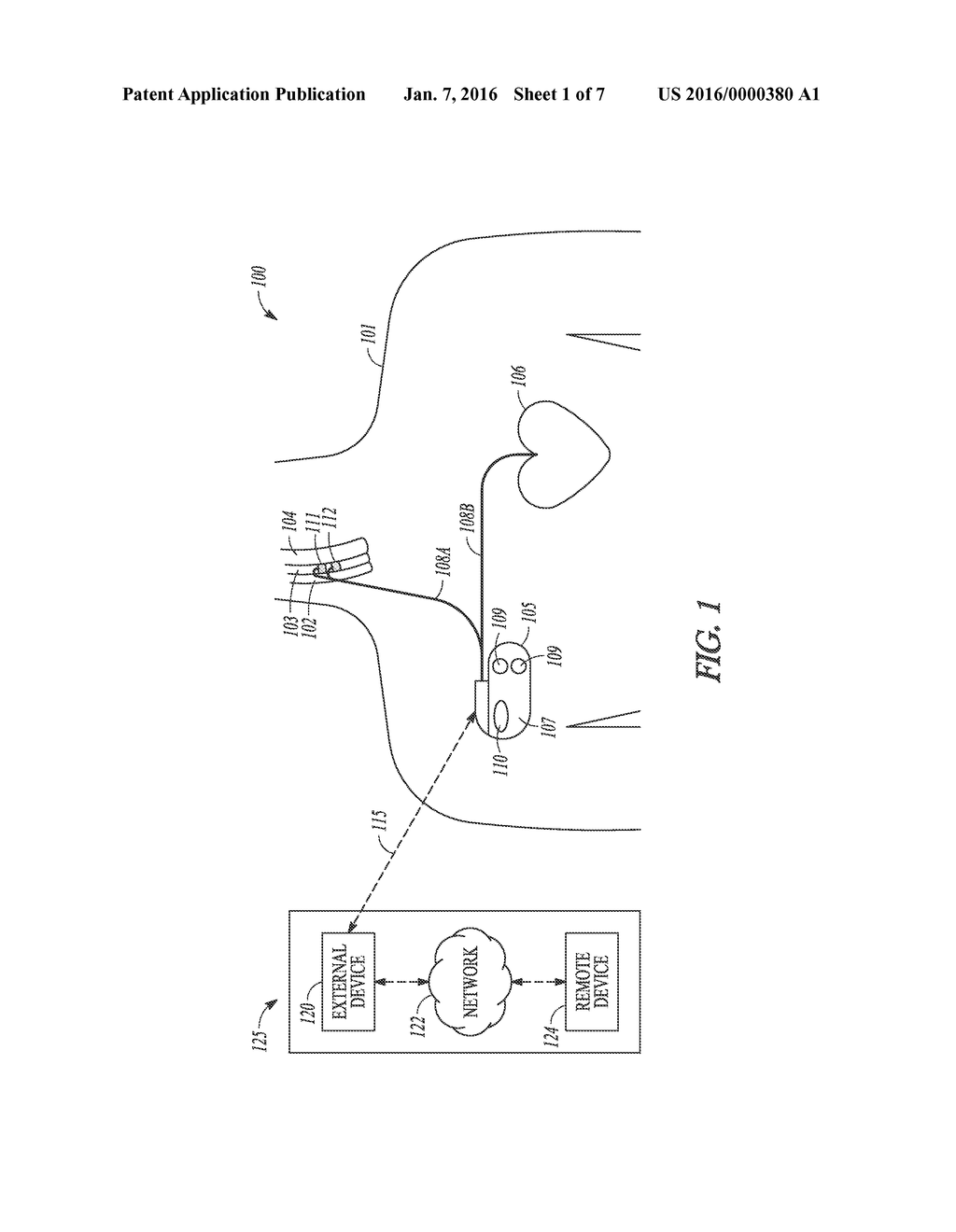 SYSTEMS AND METHODS FOR DETECTING MEDICAL TREATMENT - diagram, schematic, and image 02