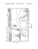 METHODS FOR MARKING BIOPSY LOCATION diagram and image