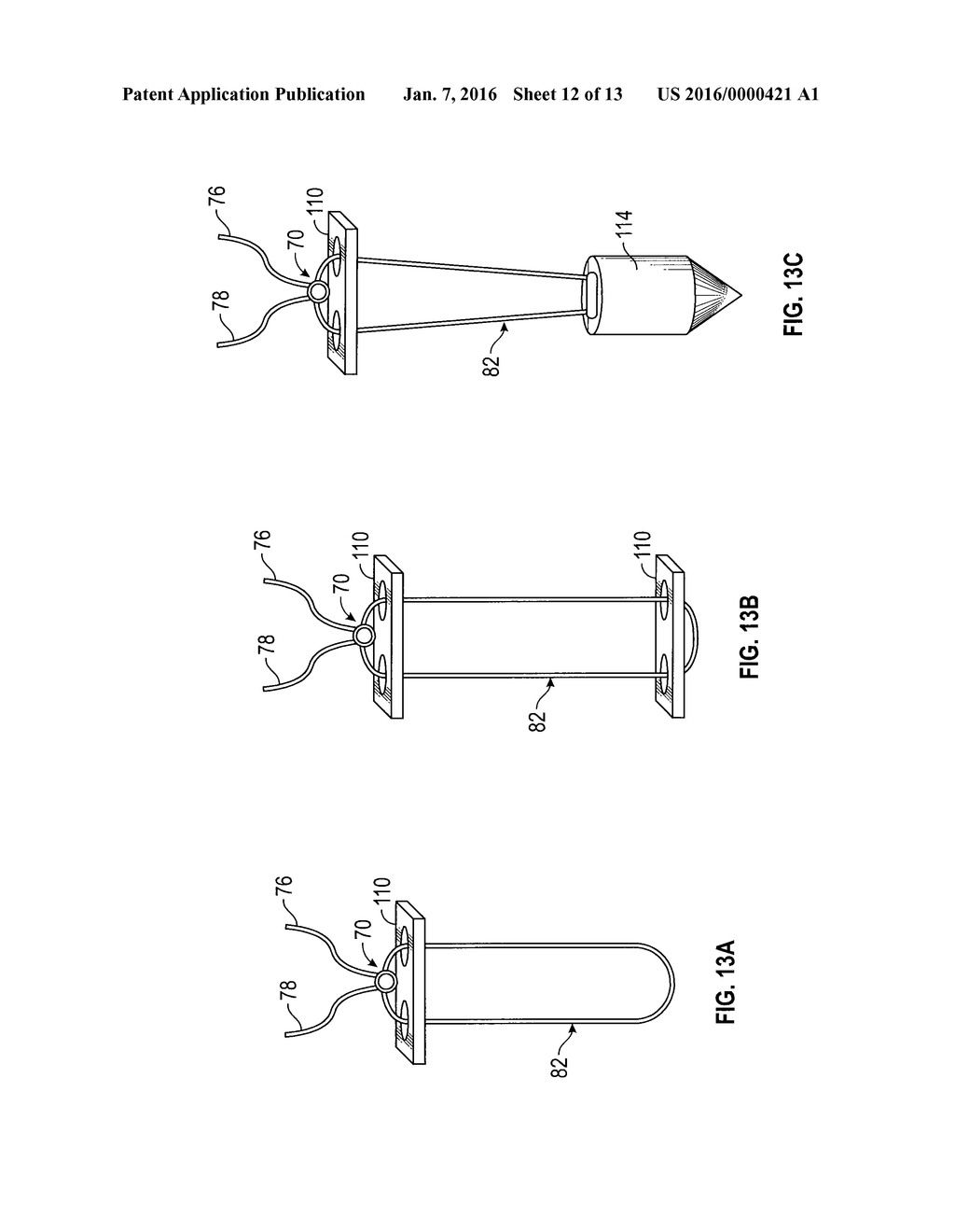 ADJUSTABLE SUTURE KNOT - diagram, schematic, and image 13