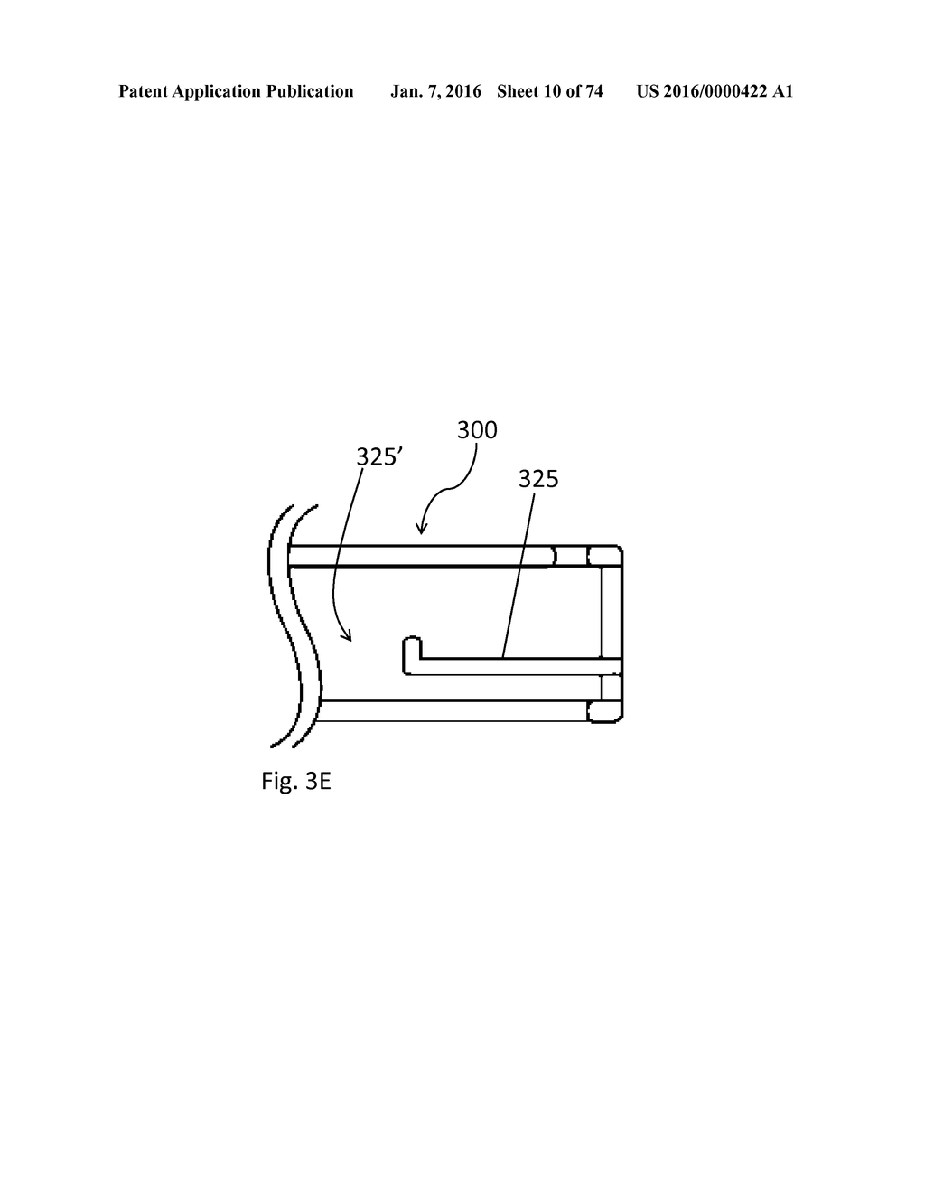 Apparatus and methods for Loading Suture - diagram, schematic, and image 11