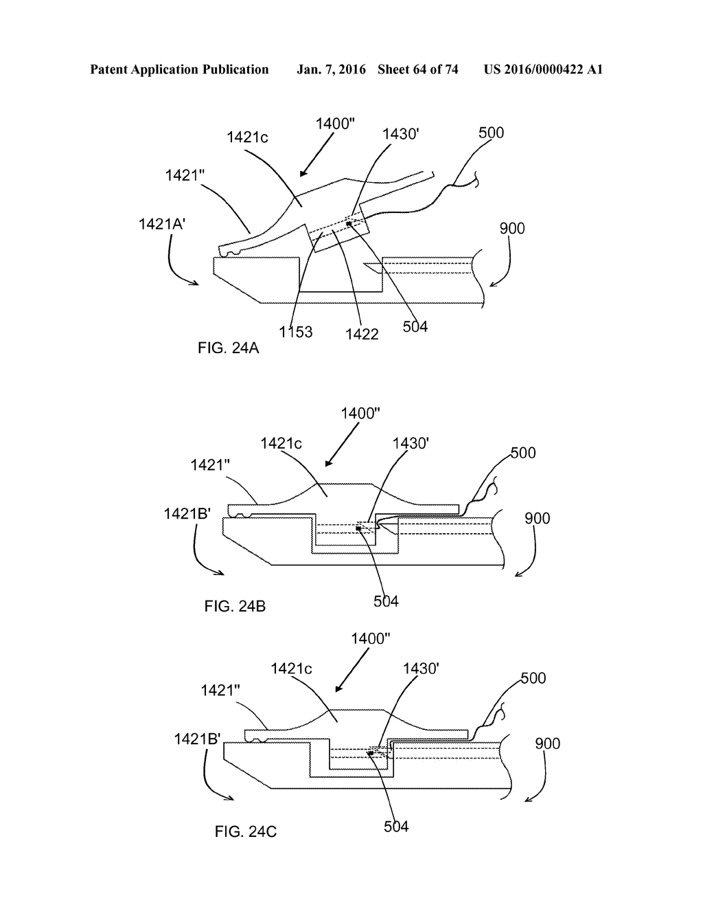 Apparatus and methods for Loading Suture - diagram, schematic, and image 65