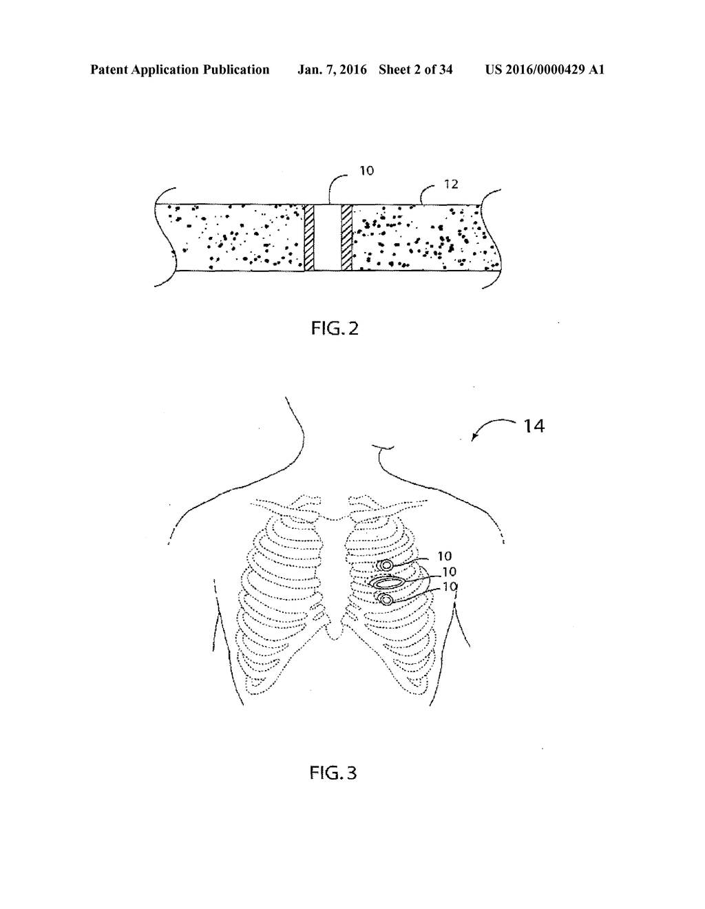 METHOD FOR SURGICAL STAPLING - diagram, schematic, and image 03