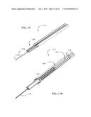 METHOD FOR SURGICAL STAPLING diagram and image