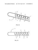 METHOD FOR SURGICAL STAPLING diagram and image