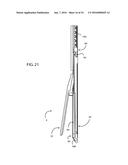 METHOD FOR SURGICAL STAPLING diagram and image