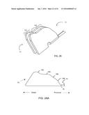 METHOD FOR SURGICAL STAPLING diagram and image