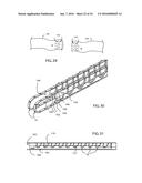 METHOD FOR SURGICAL STAPLING diagram and image