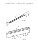 METHOD FOR SURGICAL STAPLING diagram and image