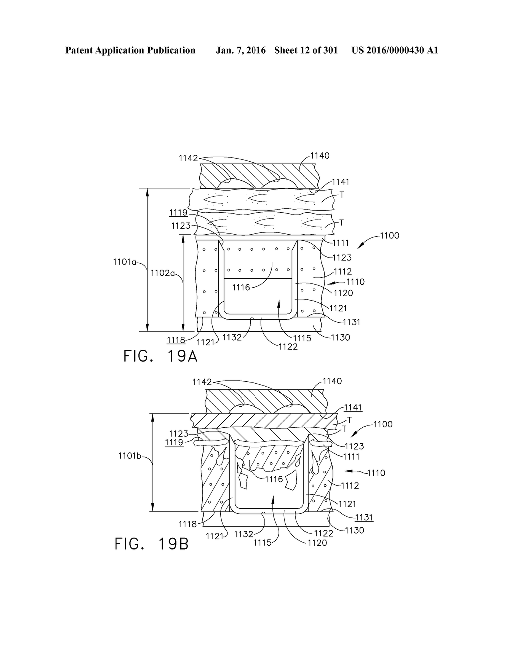 TISSUE STAPLER HAVING A THICKNESS COMPENSATOR INCORPORATING AN     ANTI-MICROBIAL AGENT - diagram, schematic, and image 13