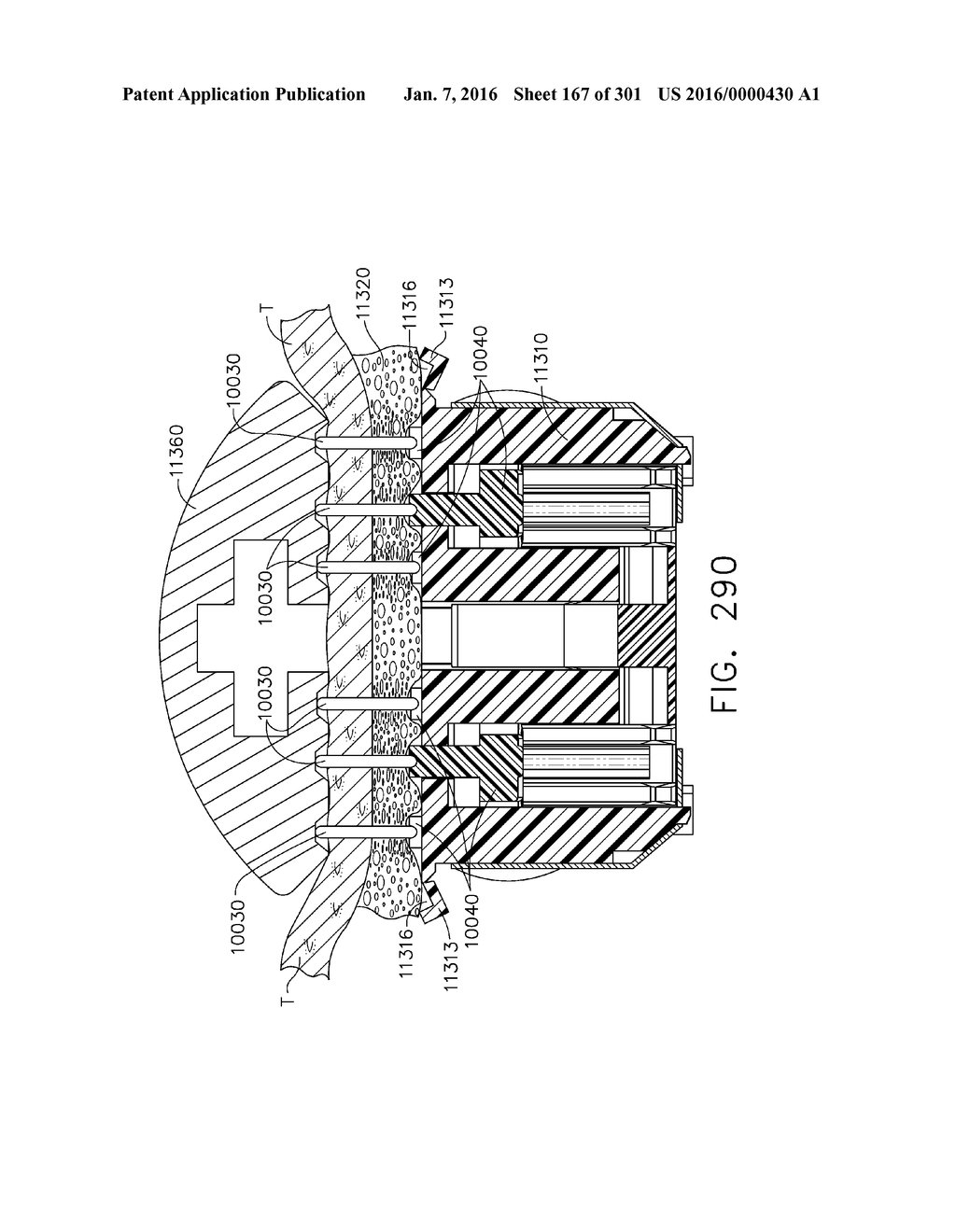 TISSUE STAPLER HAVING A THICKNESS COMPENSATOR INCORPORATING AN     ANTI-MICROBIAL AGENT - diagram, schematic, and image 168