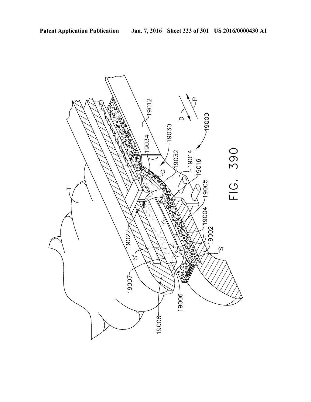 TISSUE STAPLER HAVING A THICKNESS COMPENSATOR INCORPORATING AN     ANTI-MICROBIAL AGENT - diagram, schematic, and image 224