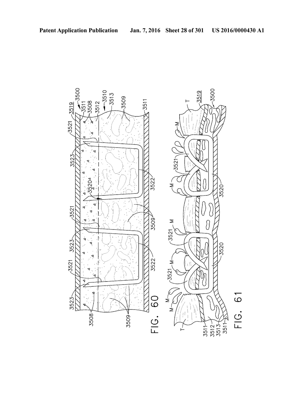 TISSUE STAPLER HAVING A THICKNESS COMPENSATOR INCORPORATING AN     ANTI-MICROBIAL AGENT - diagram, schematic, and image 29