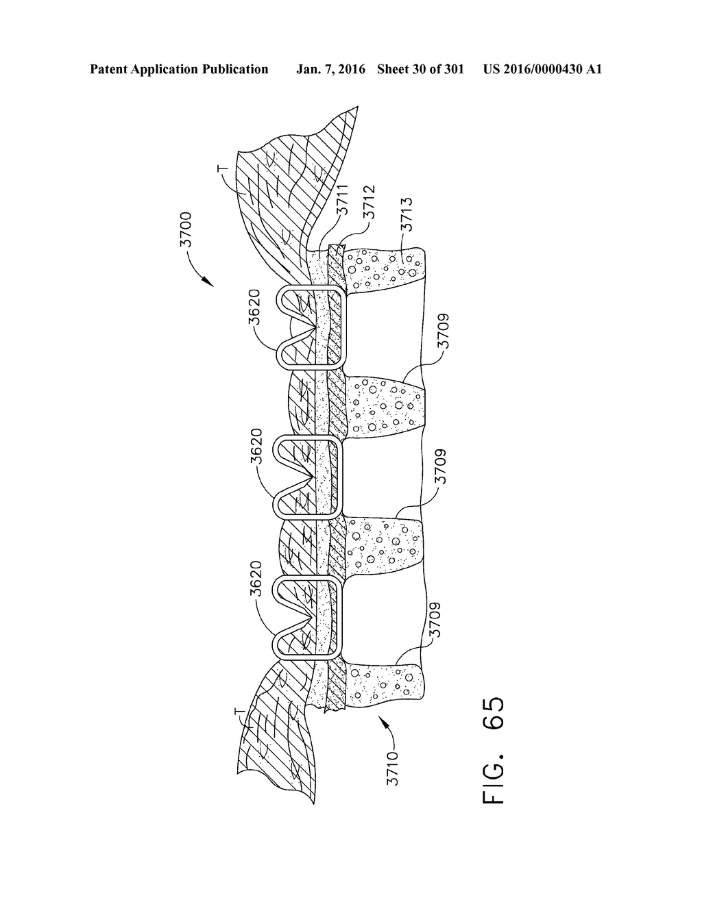 TISSUE STAPLER HAVING A THICKNESS COMPENSATOR INCORPORATING AN     ANTI-MICROBIAL AGENT - diagram, schematic, and image 31