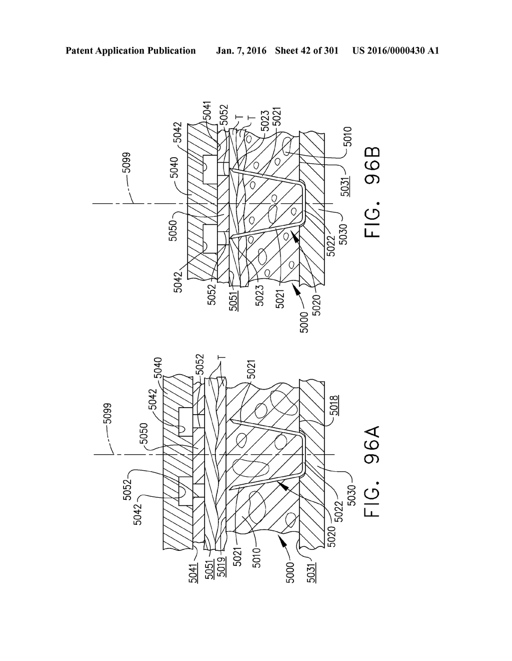 TISSUE STAPLER HAVING A THICKNESS COMPENSATOR INCORPORATING AN     ANTI-MICROBIAL AGENT - diagram, schematic, and image 43