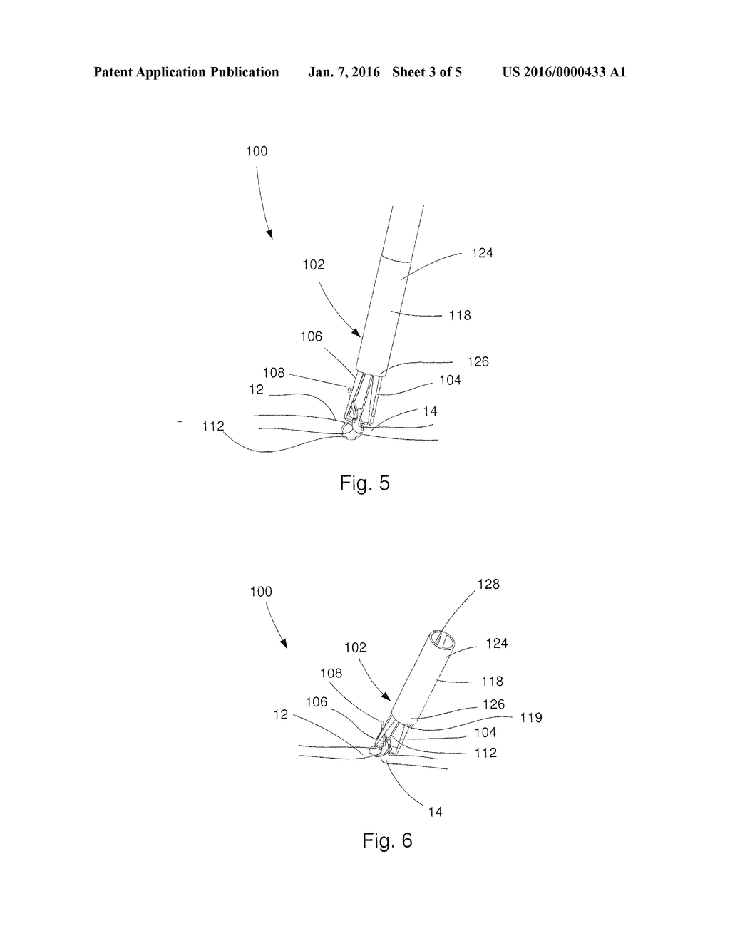 Hemostatic Clip With Needle Passer - diagram, schematic, and image 04