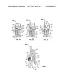 ADJUSTABLE FORCEPS FOR OSTEOSYNTHESIS CLIP diagram and image