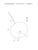 METHODS AND DEVICES FOR URETHRAL TREATMENT diagram and image