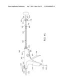 METHODS AND DEVICES FOR URETHRAL TREATMENT diagram and image