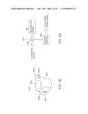 METHODS AND DEVICES FOR URETHRAL TREATMENT diagram and image